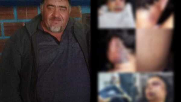 Mujer brutalmente agredida por su ex pareja en San Cosme y Damián
