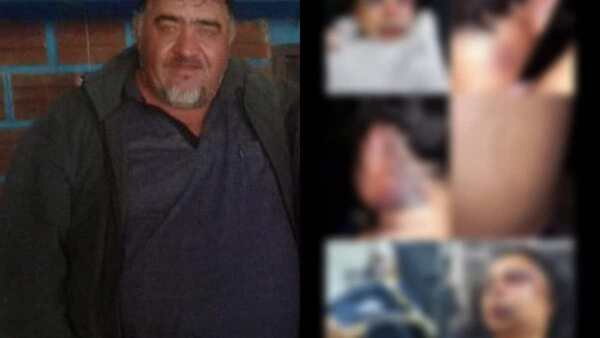 EL ESCALOFRIANTE RELATO DE UN INTENTO DE FEMINICIDIO EN SAN COSME Y DAMIAN