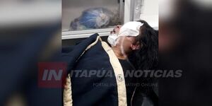 MUJER HABRÍA SIDO BRUTALMENTE GOLPEADA POR SU EX PAREJA - Itapúa Noticias