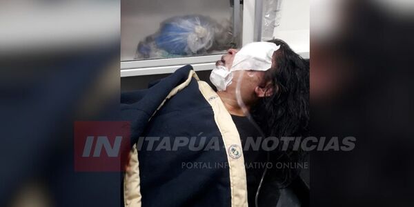 MUJER HABRÍA SIDO BRUTALMENTE GOLPEADA POR SU EX PAREJA - Itapúa Noticias