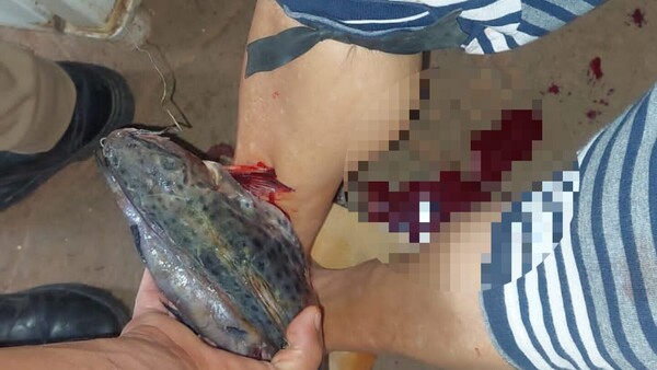 Pescado se “clavó” en la pierna de una señora