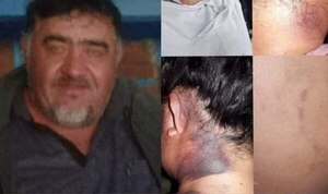 Diario HOY | Mujer fue golpeada brutalmente por su expareja en San Cosme y Damián