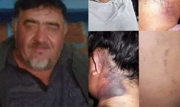 Diario HOY | Mujer fue golpeada brutalmente por su expareja en San Cosme y Damián