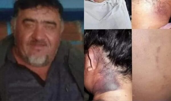 Investigan intento de feminicidio en San Cosme y Damián - Policiales - ABC Color