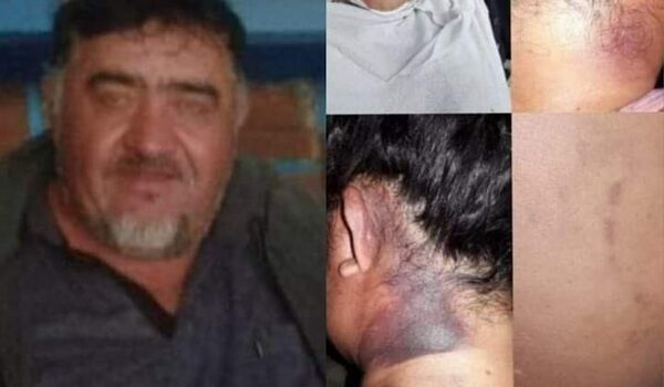 Hombre desfiguró a golpes a su expareja y huyó - Noticiero Paraguay