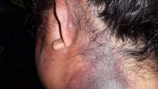 Brutal golpiza a una mujer en intento de feminicidio en San Cosme y Damián