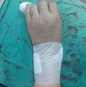 Aprehenden a un hombre tras herir a machetazos a su hermana - ABC en el Este - ABC Color