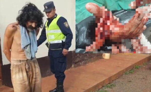 Casi destrozó la mano de su hermana con un machete