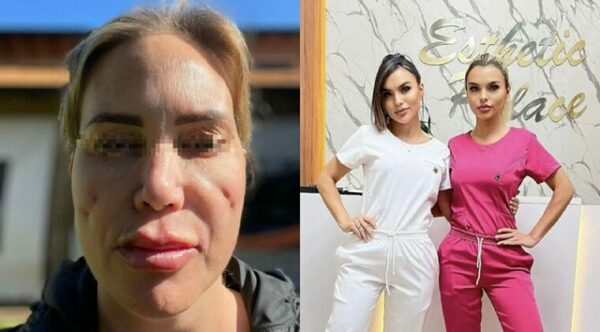 Denuncian por mala praxis a “doctoras barbies”: relato es de terror - Radio Imperio 106.7 FM