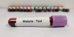Ministerio de Salud reporta la detección de un caso de malaria en Alto Paraná - Portal Digital Cáritas Universidad Católica