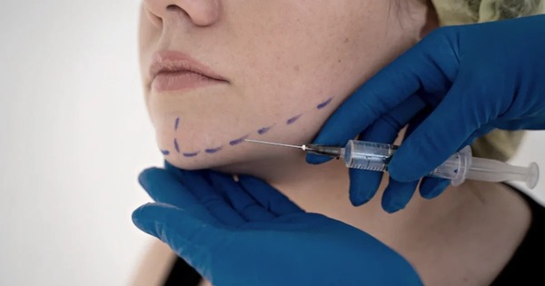 Diario HOY | Metacrilato: sustancia que causa insuficiencia renal y síndrome inflamatorio crónico