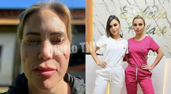 En la denuncia por mala praxis a “doctoras barbies”, relatos de las víctimas son de terror – Diario TNPRESS