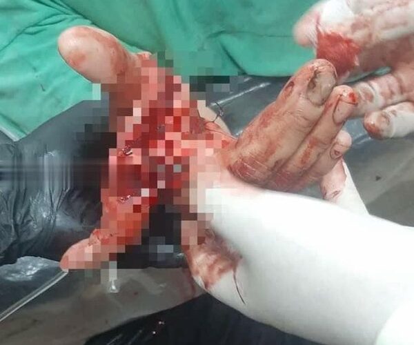 Violento sujeto casi mató a machetazos a su hermana en Km 14 Monday de Minga Guazú – Diario TNPRESS