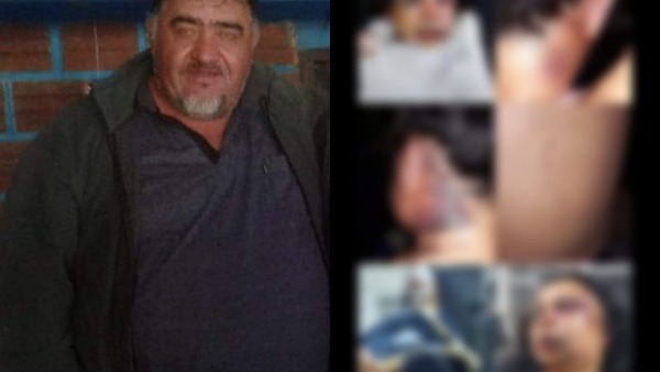 Solicitarán captura internacional de hombre que golpeó brutalmente a su expareja | 1000 Noticias