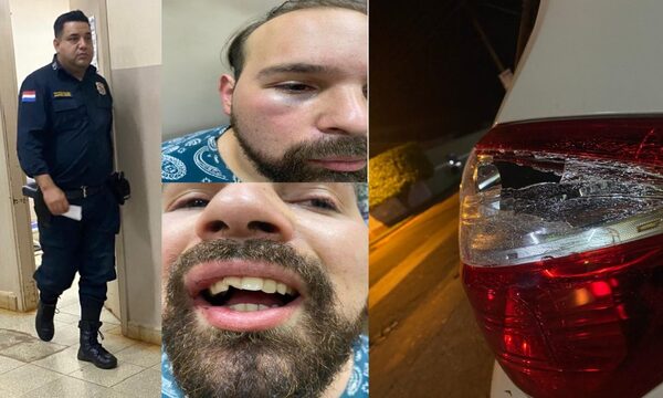 Diario HOY | Hombre denunció que fue agredido brutalmente por agentes policiales