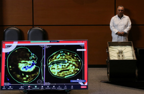 En el Congreso de México exhiben dos cuerpos "no humanos" y piden reconocer la vida extraterrestre - El Trueno