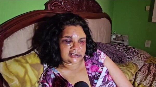 Mujer brutalmente agredida por su ex pareja relata momentos de terror