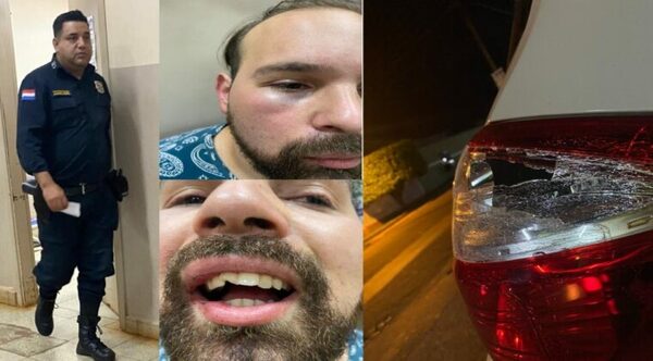 Hombre denunció que fue brutalmente golpeado por policías