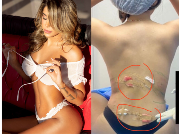 (VIDEO) ¡Maga Caballero denuncia a una odontóloga que hace lipos en una cabina de masajes!
