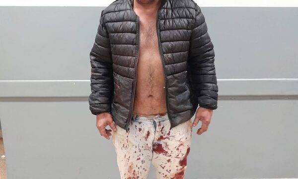 Hieren a hombre en su vivienda