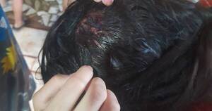 La Nación / Mujer denunció brutal agresión de su pareja con barra de hierro, frente a sus hijos