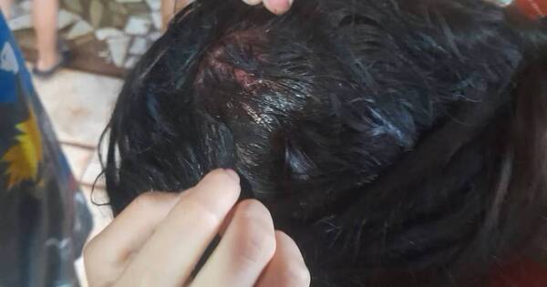 La Nación / Mujer denunció brutal agresión de su pareja