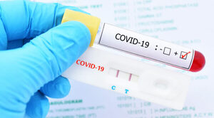 COVID-19, con tendencia al aumento, señala reporte