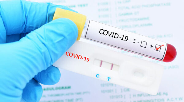 COVID-19, con tendencia al aumento, señala reporte