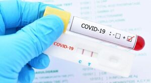 COVID-19, con tendencia al aumento, señala reporte