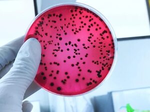 Una bacteria intestinal que contiene ácido sulfúrico nos protege contra la salmonella - Ciencia - ABC Color