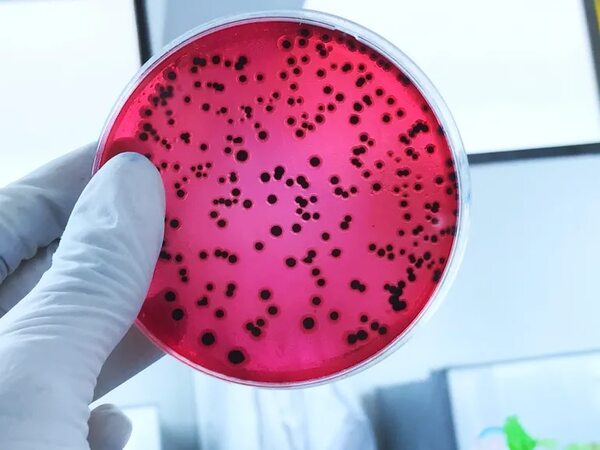 Una bacteria intestinal que contiene ácido sulfúrico nos protege contra la salmonella - Ciencia - ABC Color