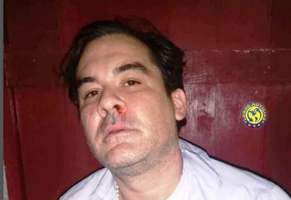 Diario HOY | Muere hincha de Luque: apuntan a microtraficantes metidos en "barras organizadas"