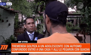 Golpean a adolescente con autismo en Areguá | Telefuturo