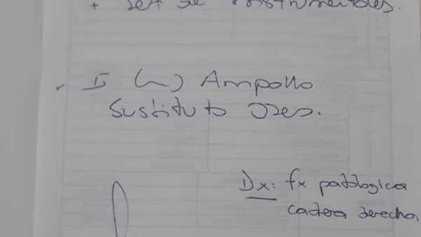Niño necesita ayuda para operarse del ojo derecho