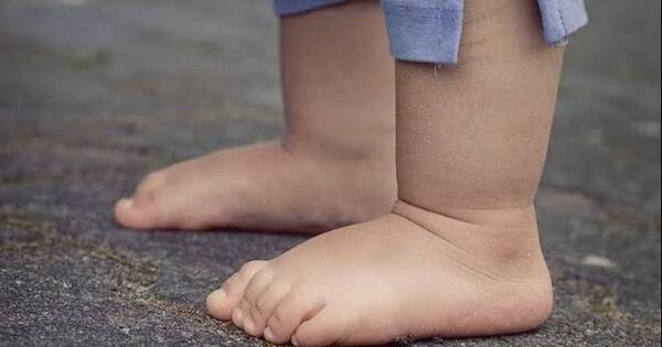 La Nación / Paraguay cumple objetivos de desarrollo sostenible en desnutrición y mortalidad infantil