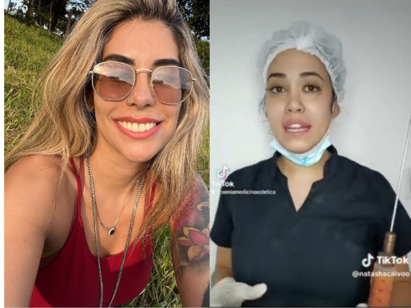 Asaltaron, robaron y golpearon a Maga Caballero: ¡Ella culpa a odontóloga que hace lipos!!