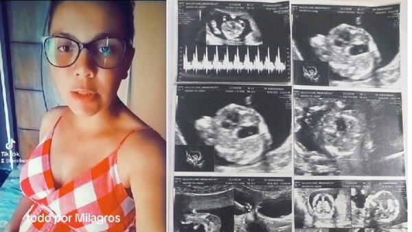 Embarazada debe ir a Uruguay para salvar a su bebé y pide ayuda con el pasaje