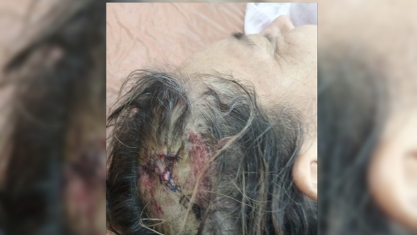 Accidente deja dos mujeres heridas en Cambyretá