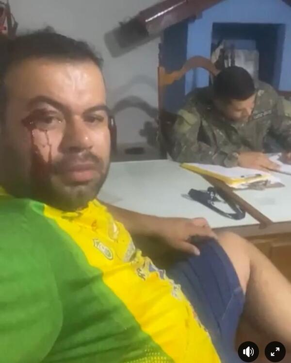 Agredieron y amenazaron al concejal "Beto Denis" de Capitán Bado