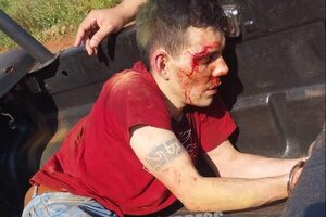 Asaltante cae después de golpear brutalmente a trabajadores para robarles Km 11 y 12 Monday – Diario TNPRESS