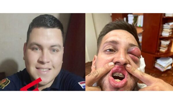 Guardiacárcel acusado de desfigurar a un joven tras pelea