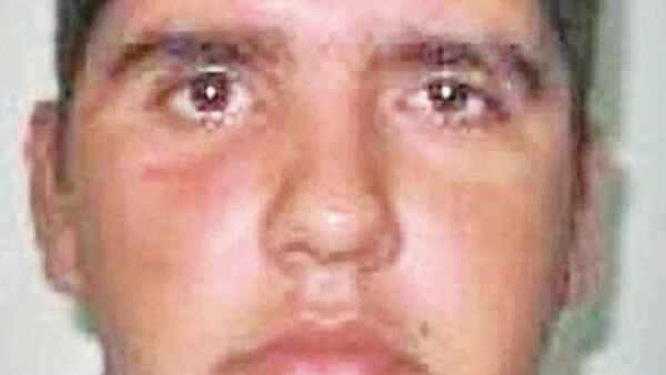 Amputan una pierna a suboficial baleado por marihuaneros en Capitán Bado