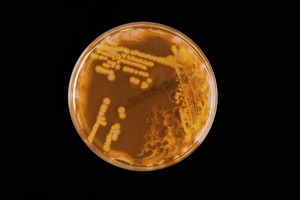 Diario HOY | Actividad de feriado: proponen muestra interactiva sobre superbacterias