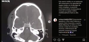 En IPS realizan exitoso bypass arterial en criatura para restablecer irrigación del cerebro - La Tribuna