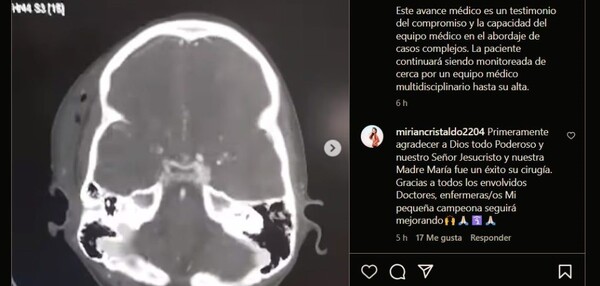 En IPS realizan exitoso bypass arterial en criatura para restablecer irrigación del cerebro - La Tribuna