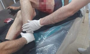 Balean a guardia en intento de asalto a distribuidora de lácteos