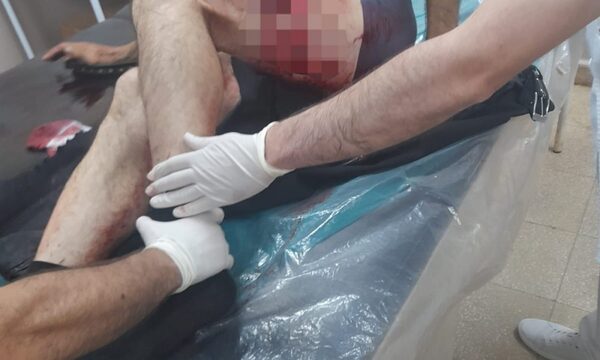 Balean a guardia en intento de asalto a distribuidora de lácteos
