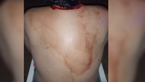 Mujer hiere a su pareja con un martillo tras discusión