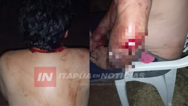 HOMBRE FUE HOSPITALIZADO TRAS RECIBIR MARTILLAZOS DE SU PAREJA - Itapúa Noticias