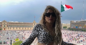Kathy Di Quinto sufrió fuertes quemaduras por exposición al sol - EPA